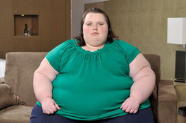 Béo phì khi mới 20 - 30 tuổi khiến bạn chết sớm hơn 10 năm