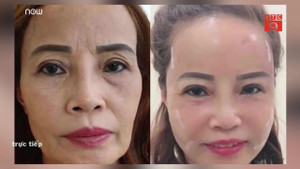 Video: Cô dâu 62 tuổi phẫu thuật thẩm mỹ, nhan sắc mới trẻ trung như 40 tuổi