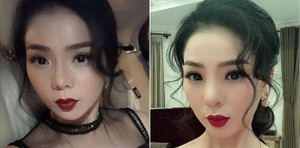 Lệ Quyên phải tháo sụn mũi gấp vì sưng nặng, nguy cơ hoại tử