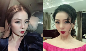 Sau khi tháo sụn mũi vì nguy cơ hoại tử, tình hình hiện tại của Lệ Quyên ra sao?