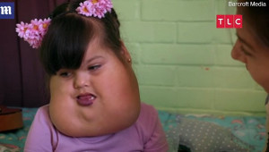 Clip: Xót xa bé gái 5 tuổi có khối u khổng lồ trên mặt