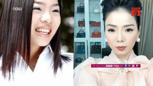 Video: Nhan sắc Lệ Quyên trước và sau khi phẫu thuật thẩm mỹ