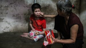 Vợ chồng già bệnh tật còm cõi chăm con bại não gần 30 năm