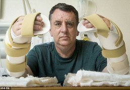 Clip: Kỳ diệu người đàn ông được ghép thành công đôi bàn tay mới