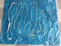 Phát hiện 108 người ở Bình Phước mắc bệnh sán dây lợn