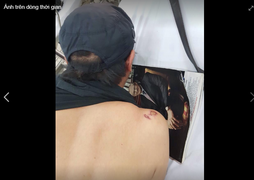 Bị tố vô cớ đánh đập, bắt giữ một đạo diễn, Công an Cần Thơ nói gì?