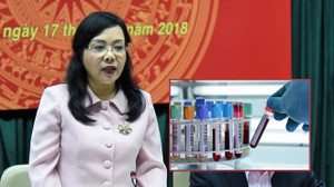 Xuất nhập khẩu mẫu máu, nước tiểu... cũng cần kiểm tra chất lượng?