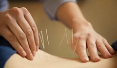 Clip: Cận cảnh trị viêm xoang bằng phương pháp cấy chỉ vào huyệt châm cứu