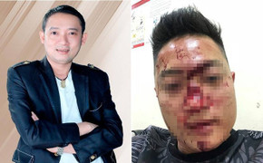 Video: Toàn cảnh lùm xùm nghệ sĩ hài Chiến Thắng bị tố thuê vệ sĩ đánh khán giả