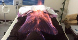 Bác sĩ lý giải việc 'trúng tà' khi sử dụng hỏa trị liệu làm đẹp