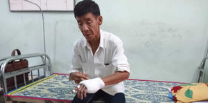 Phó trưởng công an xã ở Huế đánh người đàn ông vỡ xương ngón tay