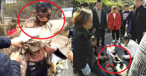 Clip: Chú rể chạy trốn khỏi đám cưới bị xe tông vỡ sọ, xuất huyết não