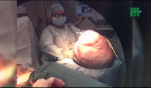 'Nuôi' khối u khổng lồ nặng 26 kg lại tưởng có bầu