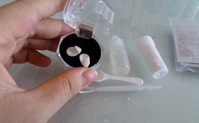 Mua răng giả gắn vào răng thật - trào lưu làm đẹp nguy hiểm của giới trẻ