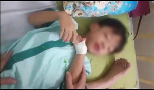 Bị chó cắn, bé 5 tuổi ở Quảng Nam thiệt mạng thương tâm