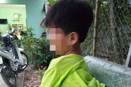 Tạm đình chỉ 15 ngày cô giáo Long An đánh học sinh khuyết tật bầm tím