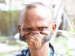 Ảnh: Điều ít biết về người đàn ông có thể dùng lưỡi liếm thẳng lên trán