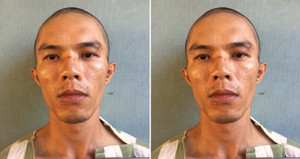 Bị truy đuổi, 2 tên trộm đạp ngã xe dân quân tự vệ ở Bình Dương