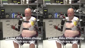 Cận cảnh đôi tay robot được điều khiển bằng chính suy nghĩ của người khuyết tật