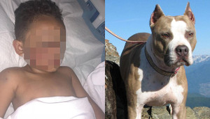 Người mẹ kể lại giây phút kinh hoàng, con trai bị chó pitbull tấn công khuôn mặt trong đau đớn