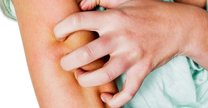 Dấu hiệu 'tố cáo' bạn bị bệnh tiểu đường - kẻ giết người thầm lặng trong cơ thể