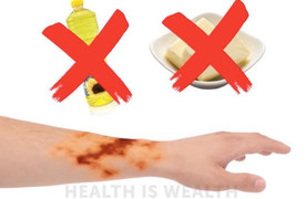 Nguy hiểm khi tự ý điều trị những bệnh tưởng chừng đơn giản sau tại nhà