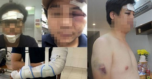 Nhóm thực khách tố bị nhân viên nhà hàng ẩm thực truy sát đến tàn phế ở TP.HCM
