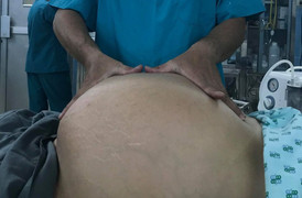 Mang khối u buồng trứng nặng 20kg, người phụ nữ 29 tuổi không thể đi lại