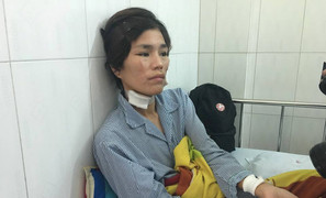 Sau ly hôn, người phụ nữ bị chồng cũ tra tấn tàn độc