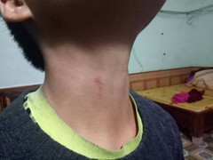 Phụ huynh tố hiệu trưởng bóp cổ học sinh, lãnh đạo Phòng GD&ĐT phủ nhận