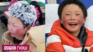'Cậu bé băng tuyết' đổi đời sau 1 năm nổi tiếng