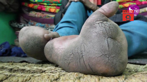 Cô gái xinh đẹp có bàn chân khổng lồ như chân voi