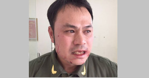 Nhân viên an ninh sân bay bị cò mồi taxi đánh gãy 4 răng cửa