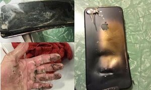 Clip: Vừa sạc vừa dùng điện thoại, thanh niên Nam Định bị nổ cụt bàn tay