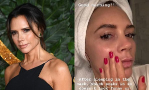 Victoria Beckham gây sốc khi dưỡng da bằng kem làm từ máu của mình