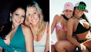 Phẫu thuật thẩm mỹ thất bại, cô gái mang bộ ngực cứng như đá