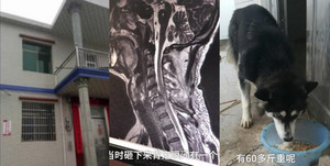 Cú phi thân từ tầng 2 của chó cưng khiến chủ gãy cổ