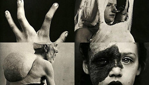 9 hình ảnh y học cổ xưa gây ám ảnh người xem