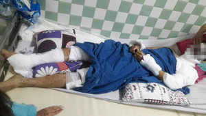 Đôi nam nữ Việt kiều bị tạt a xít, cắt gân chân ở Quảng Ngãi: Bộ Công an vào cuộc điều tra