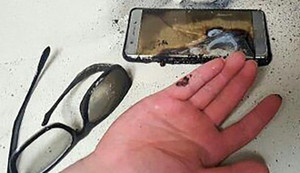 Điện thoại nổ tung khi vừa sạc vừa chơi, bé trai Bình Dương bị thương nặng