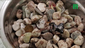 Người đàn ông nuốt 2 kg sỏi vào bụng để… giảm lo lắng