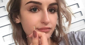 Cô gái bị cây mọc trong tai