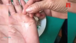 Nghi đồ ăn có sán, phụ huynh vây kín trường mầm non ở Bắc Ninh