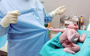 Bức ảnh bé trai chào đời níu áo bác sĩ không buông 'gây sốt' cộng đồng mạng