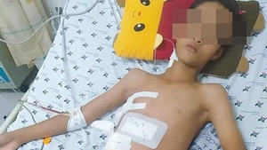 Cứu sống thành công bé trai bị thanh sắt đâm xuyên ngực