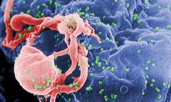 Người trưởng thành thứ ba chữa khỏi HIV