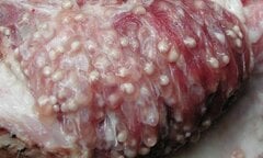 Cận cảnh thịt lợn nhiễm sán trường mầm non ở Bắc Ninh cho trẻ ăn và cách nhận biết