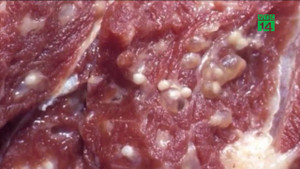 Nhiễm sán lợn nguy hiểm thế nào?