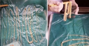 Nguyên tắc 'sống còn' trong ăn uống để không mắc sán lợn