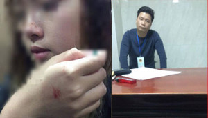 Kẻ sàm sỡ nữ sinh trong thang máy chỉ bị phạt 200 nghìn đồng, cô gái thốt lên: 'Rất buồn và bất bình'